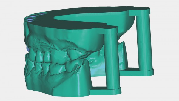 Exocad Model Creator Modul Herstellung Physischer Modelle Aus