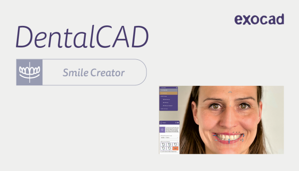 exocad Smile Creator Modul - Monatslizenz
