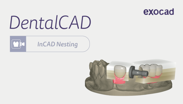 exocad In-CAD Nesting Modul - Monatslizenz
