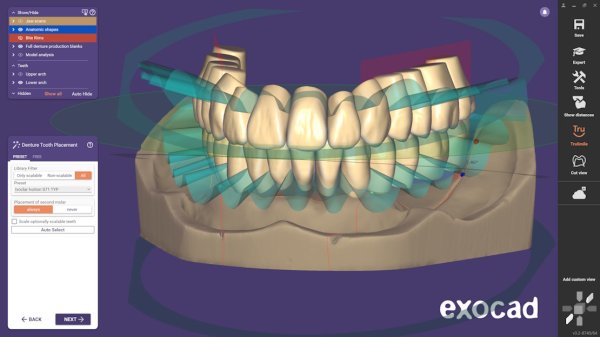 exocad Full Denture Module