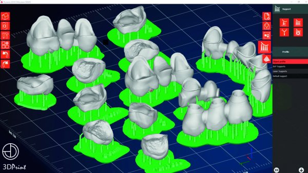 Dentoo 3D-Print Entry Testversion