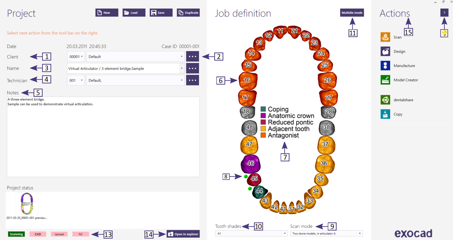 exocad StandAlone Module exocad Lizenz Dental DB
