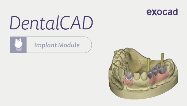 exocad Implantat Modul (Implant) - Monatslizenz