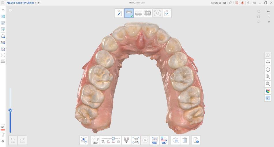 Medit Scan for Clinics – Scandaten prüfen
